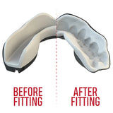 SAFEJAWZ Extro Series Fangz Self Fit Mouthguards - Black