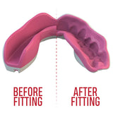 SAFEJAWZ Extro Series Fangz Self Fit Mouthguards - Pink